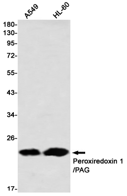 Peroxiredoxin 1/PAG Rabbit mAb ABZ2227