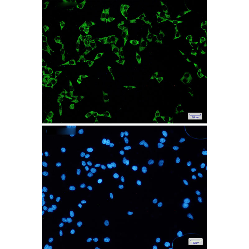 FMRP Rabbit mAb ABZ2228