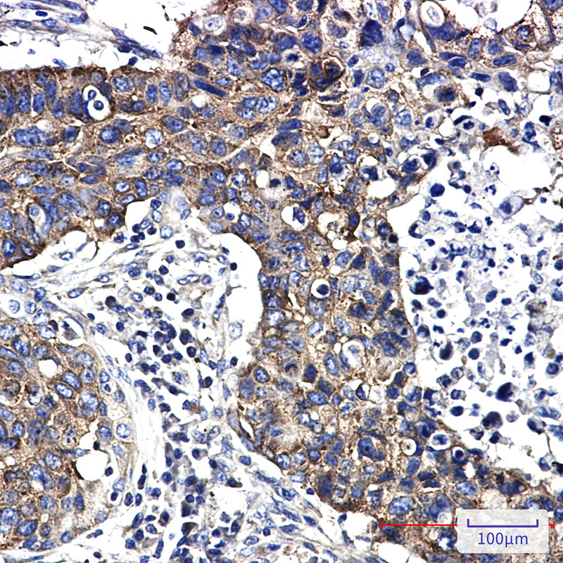 FMRP Rabbit mAb ABZ2228