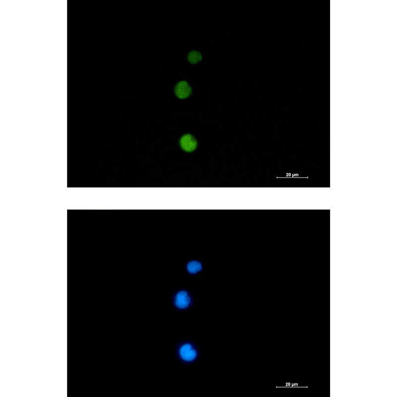 Rad51 Rabbit mAb ABZ2229