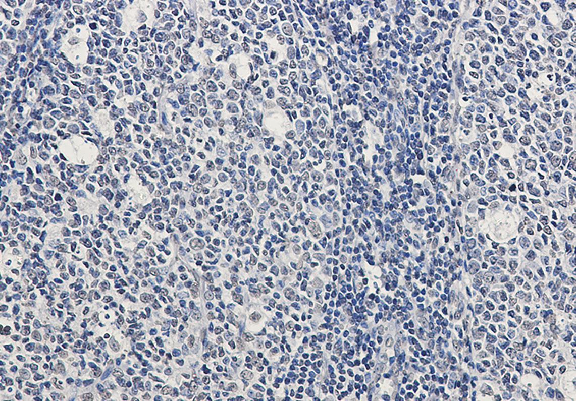 Rad51 Rabbit mAb ABZ2229