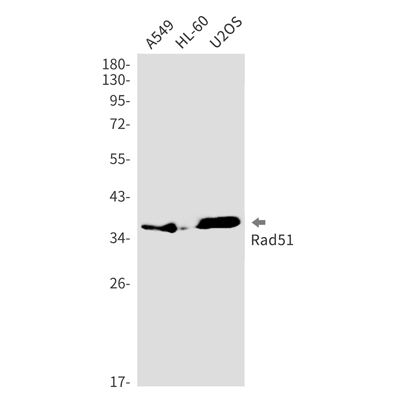 Rad51 Rabbit mAb ABZ2229