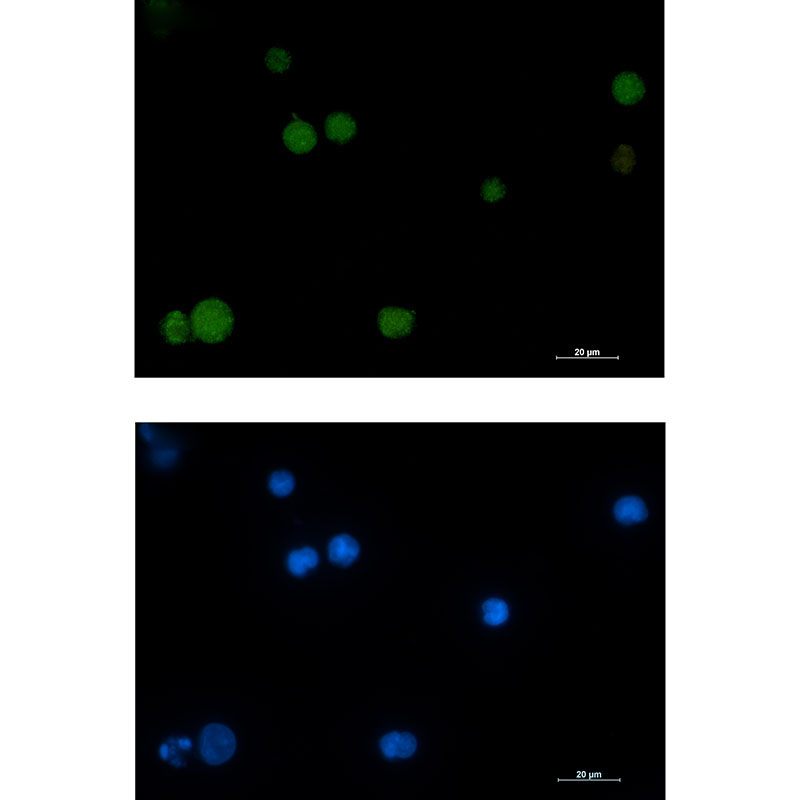 Rad51 Rabbit mAb ABZ2230