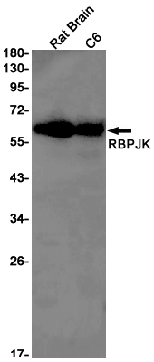RBPJK Rabbit mAb ABZ2231