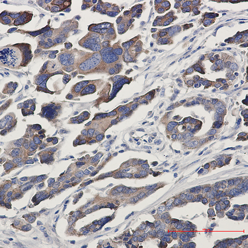 GFPT1 Rabbit mAb ABZ2232