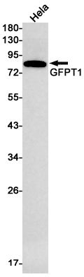 GFPT1 Rabbit mAb ABZ2232