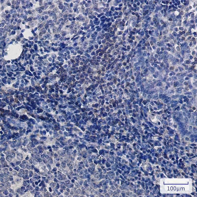 BTK Rabbit mAb ABZ2233
