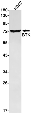 BTK Rabbit mAb ABZ2233