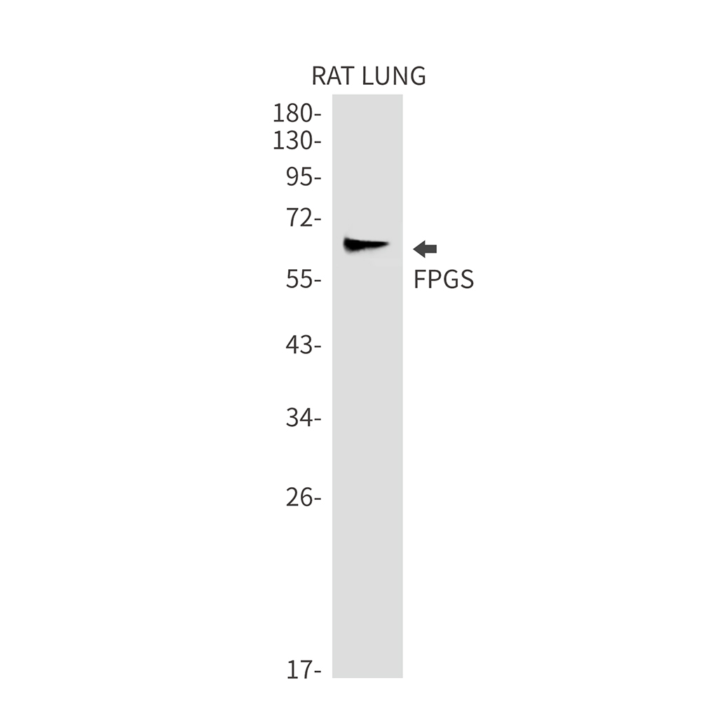FPGS Rabbit mAb ABZ2234
