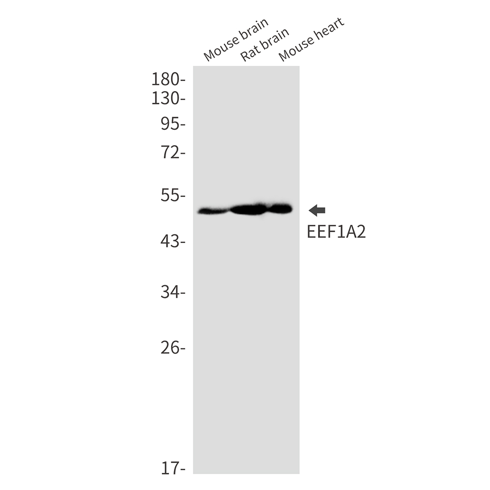 EEF1A2 Rabbit mAb ABZ2236
