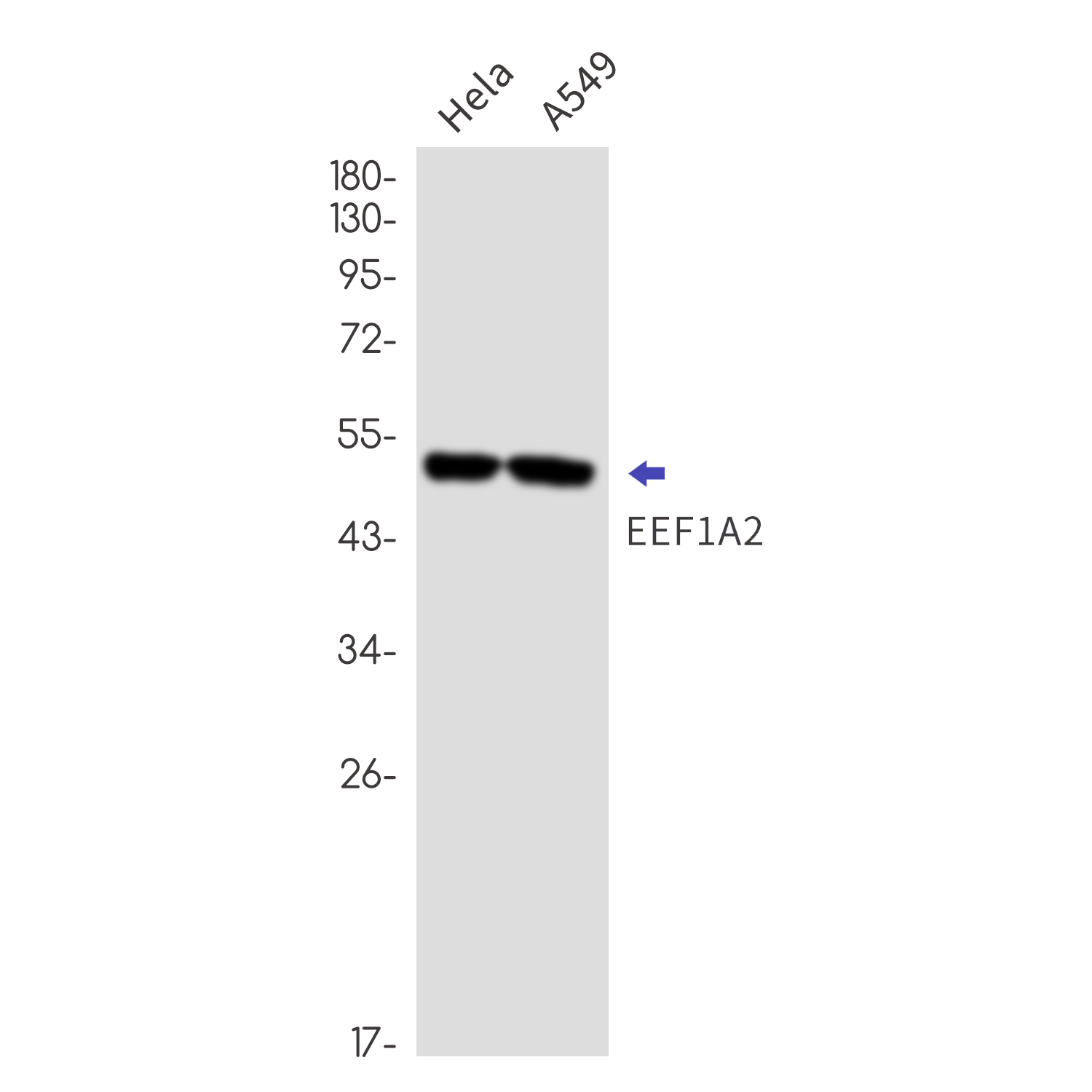 EEF1A2 Rabbit mAb ABZ2236