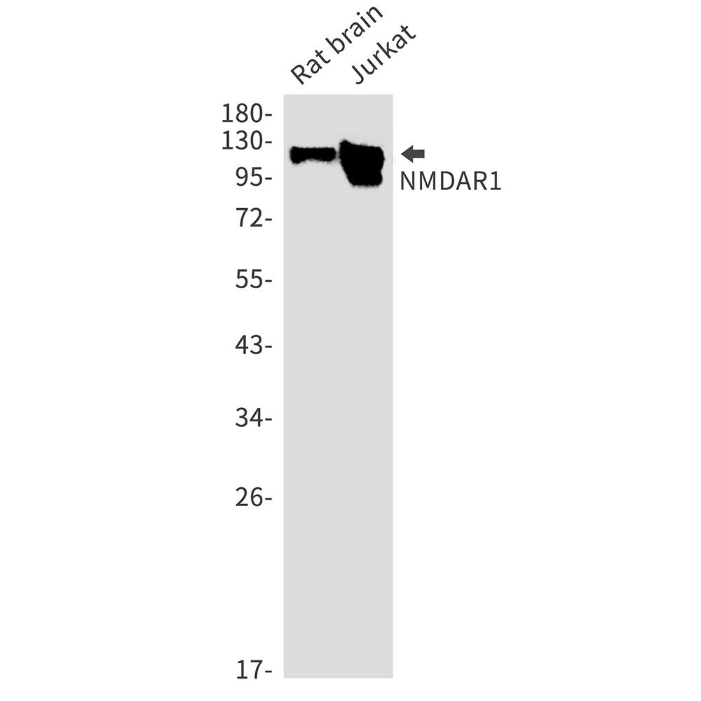 NMDAR1 Rabbit mAb ABZ2237