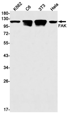 FAK Rabbit mAb ABZ2238
