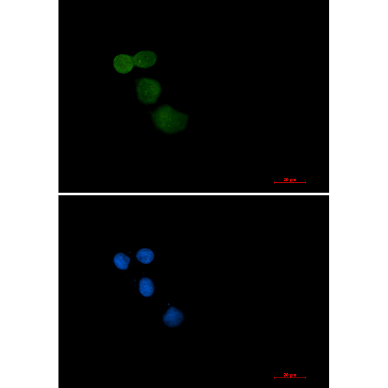 Ubiquitin Protein Ligase E3A Rabbit mAb ABZ2240