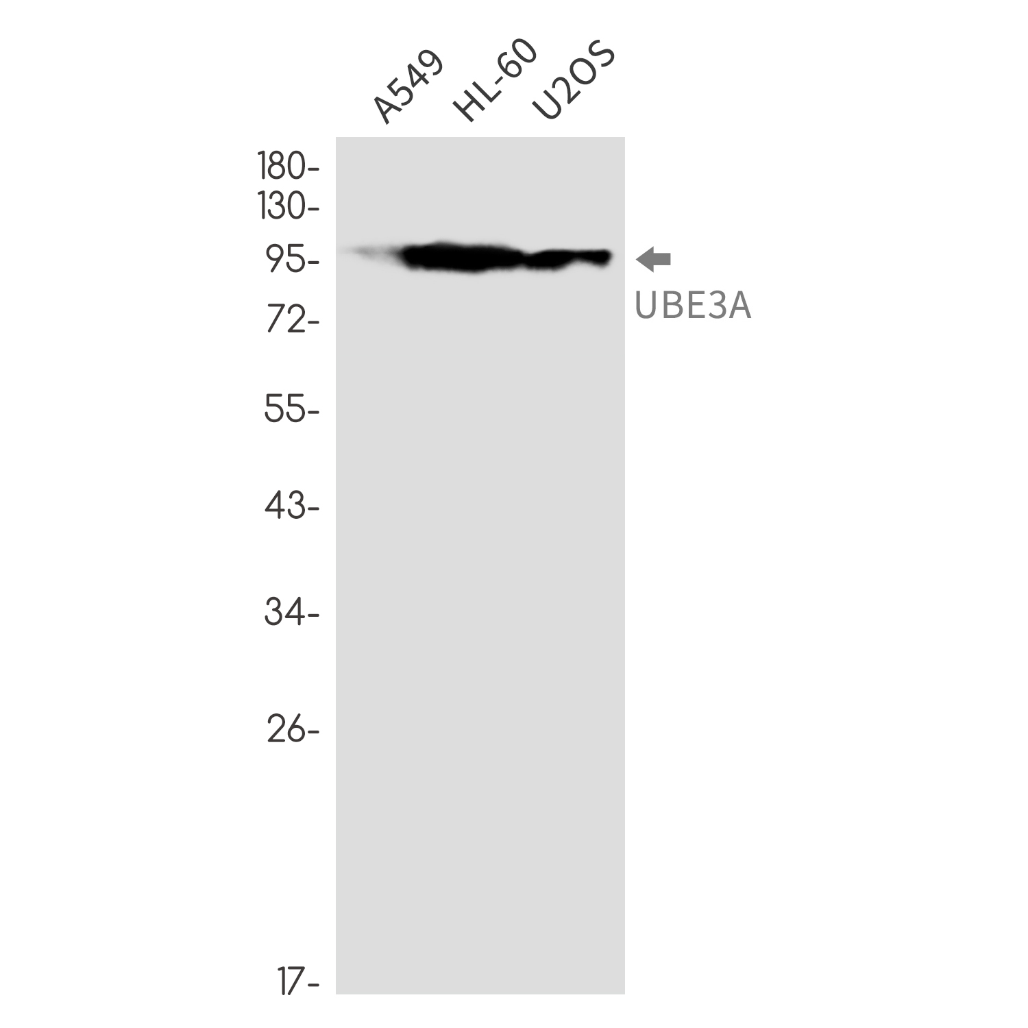Ubiquitin Protein Ligase E3A Rabbit mAb ABZ2240
