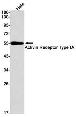 ACVR1  Rabbit mAb ABZ2242