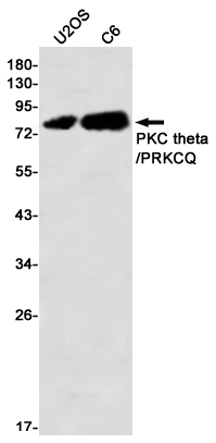 PKC theta Rabbit mAb ABZ2243