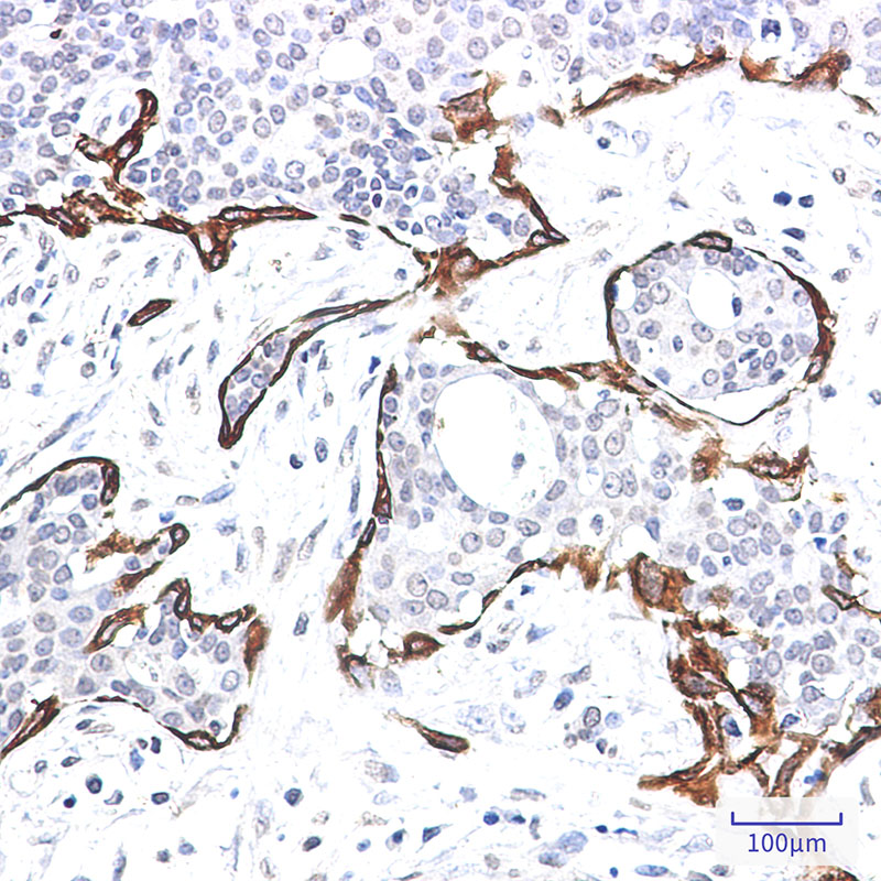 Cytokeratin 17 Rabbit mAb ABZ2244