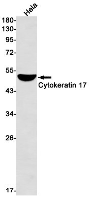 Cytokeratin 17 Rabbit mAb ABZ2244