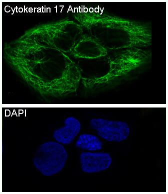 Cytokeratin 17 Rabbit mAb ABZ2245