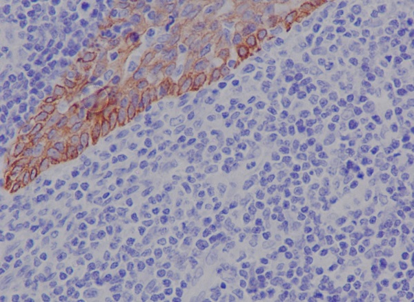 Cytokeratin 17 Rabbit mAb ABZ2245