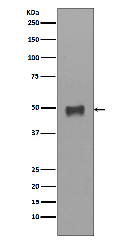 Cytokeratin 17 Rabbit mAb ABZ2245