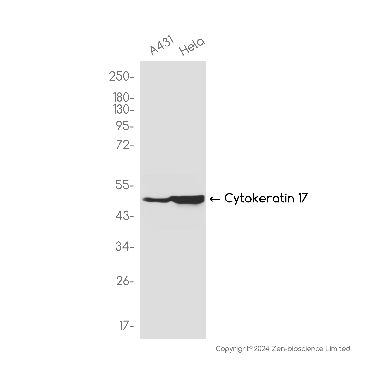 Cytokeratin 17 Rabbit mAb ABZ2245