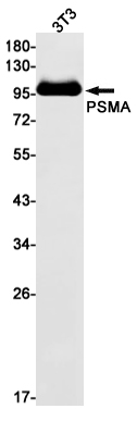 PSMA Rabbit mAb ABZ2246