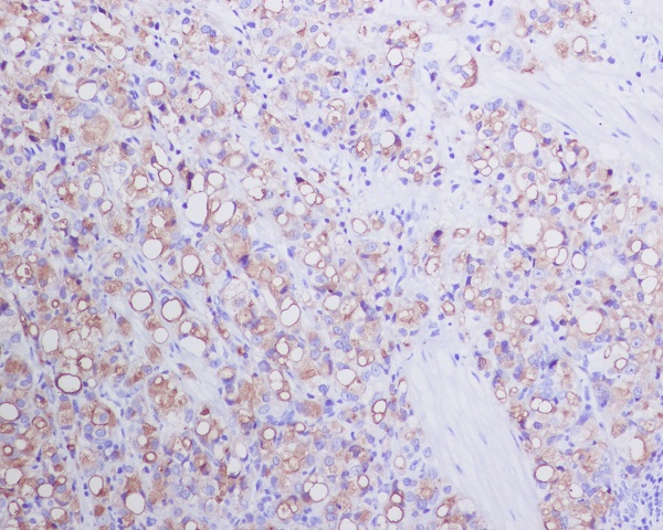 PSMA Rabbit mAb ABZ2247