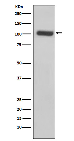 PSMA Rabbit mAb ABZ2247
