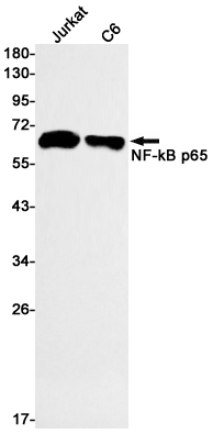 NF-KB p65 Rabbit mAb ABZ2248
