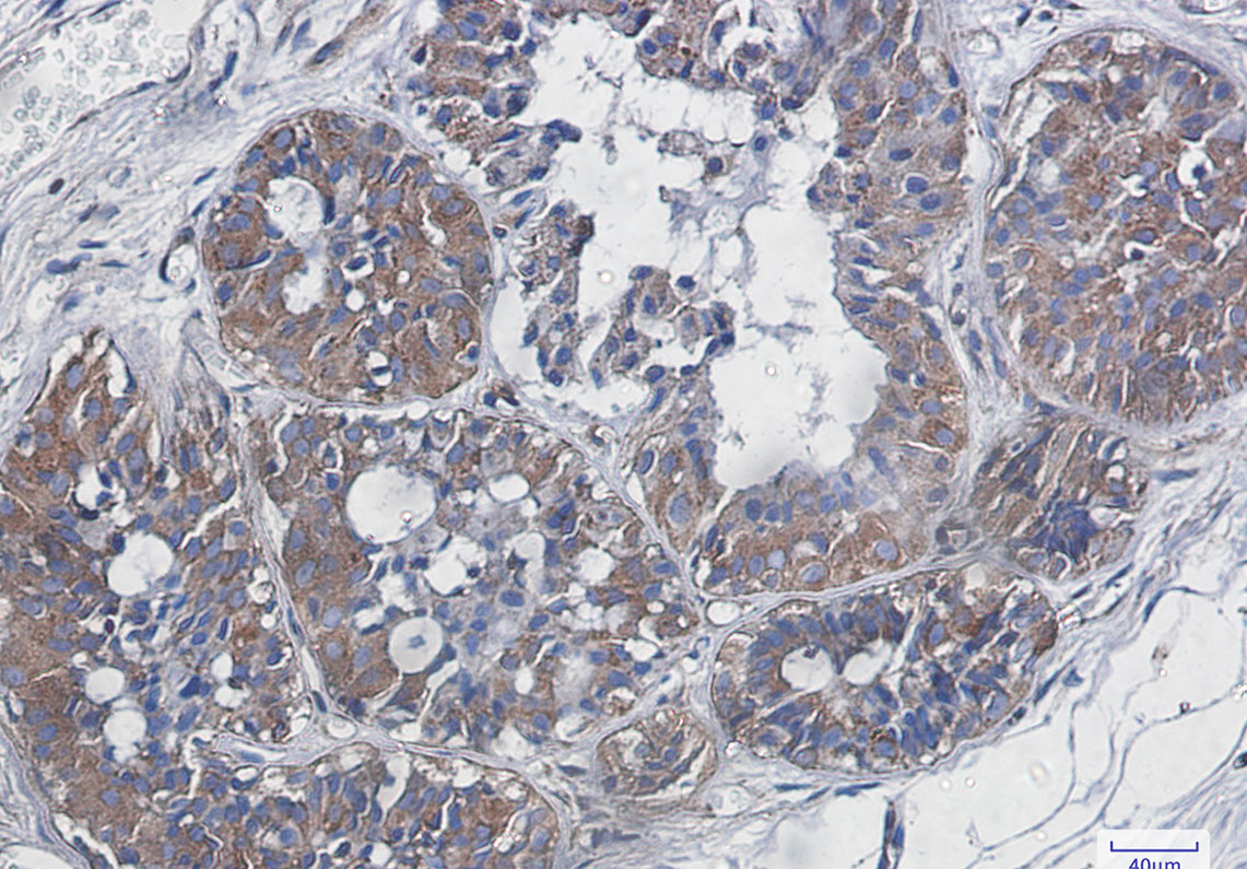 NF-KB p65 Rabbit mAb ABZ2249