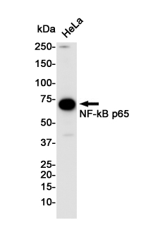 NF-KB p65 Rabbit mAb ABZ2249