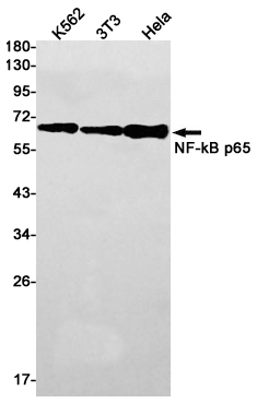 NF-KB p65 Rabbit mAb ABZ2249
