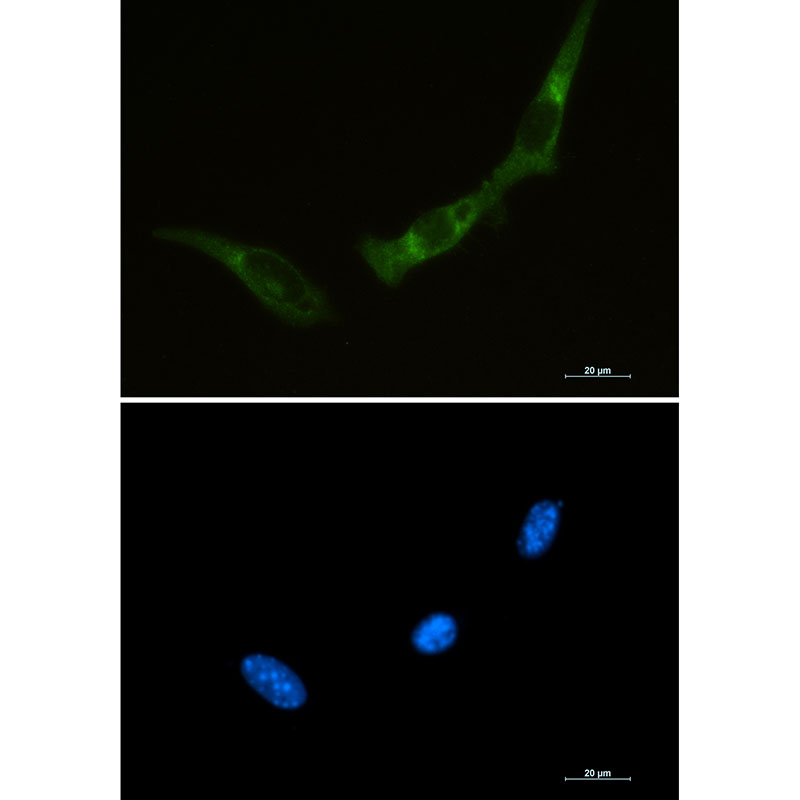 PKR Rabbit mAb ABZ2250