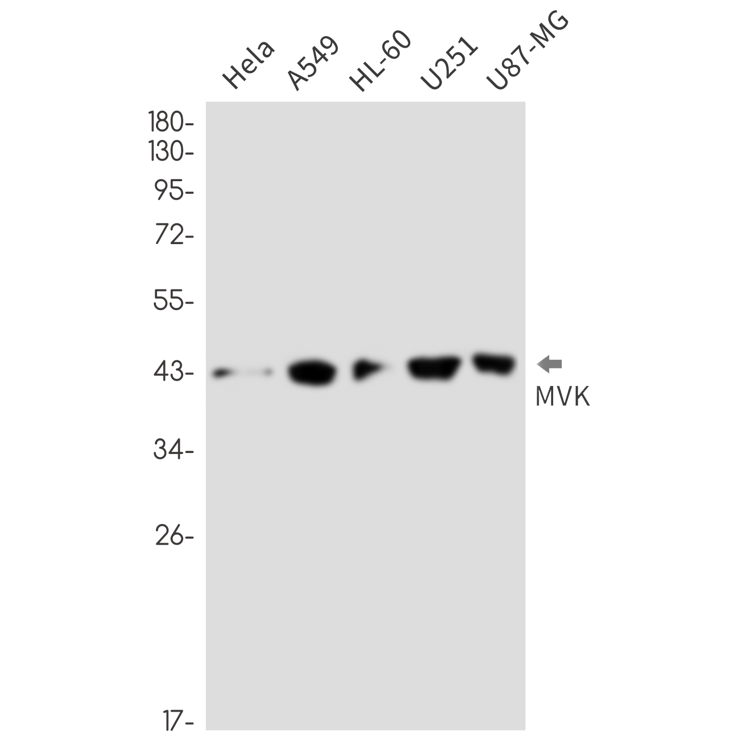 MVK Rabbit mAb ABZ2251