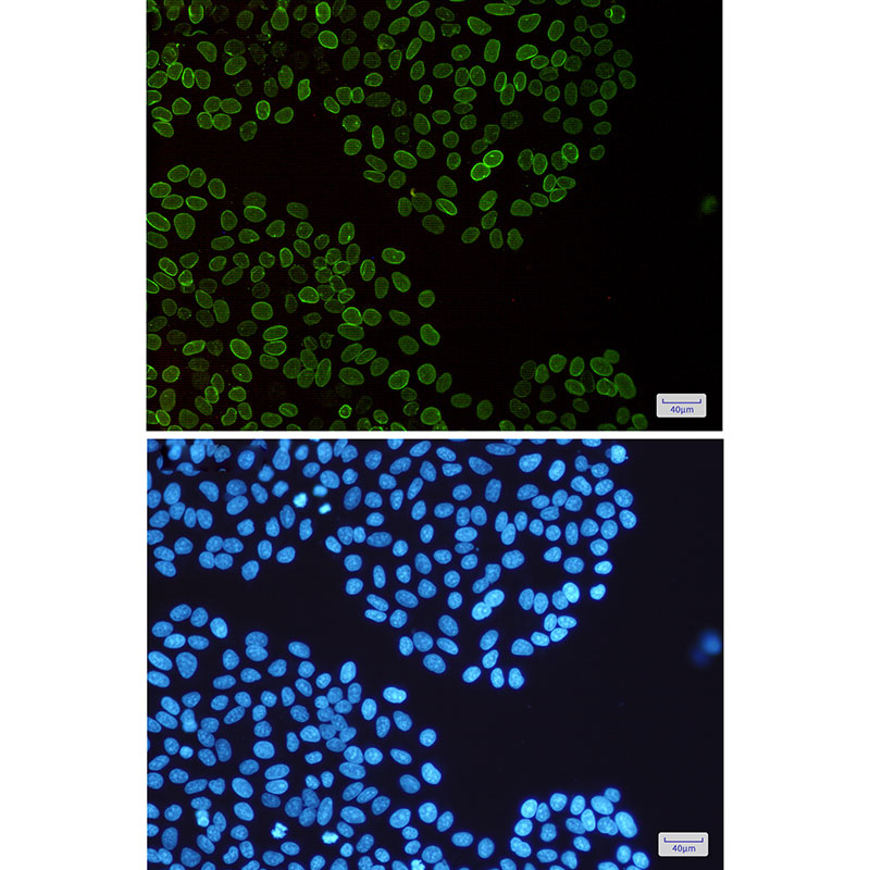 Lamin B2 Rabbit mAb ABZ2252