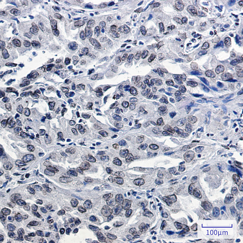 Lamin B2 Rabbit mAb ABZ2252