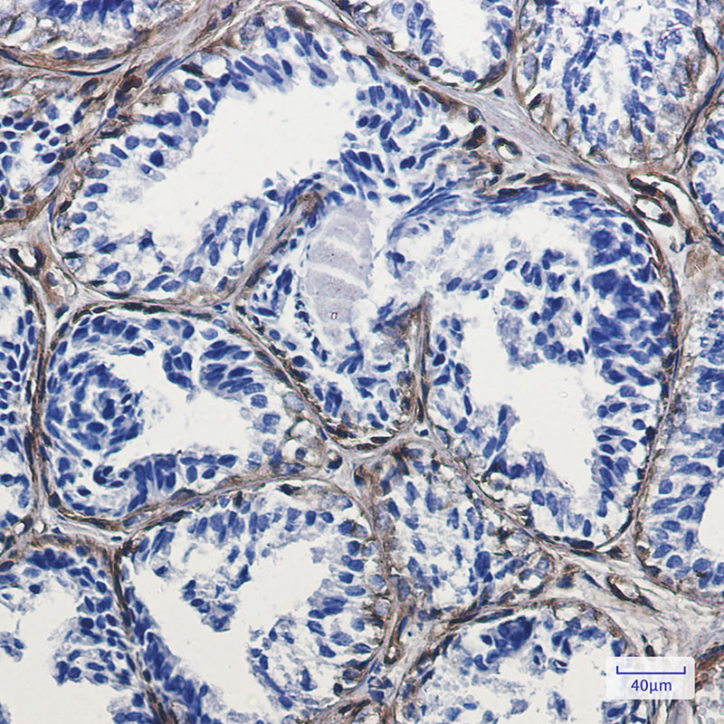 Caveolin-1 Rabbit mAb ABZ2254