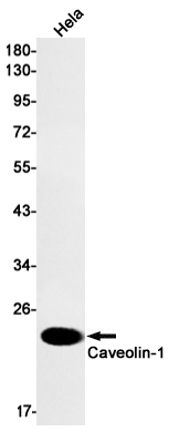 Caveolin-1 Rabbit mAb ABZ2254