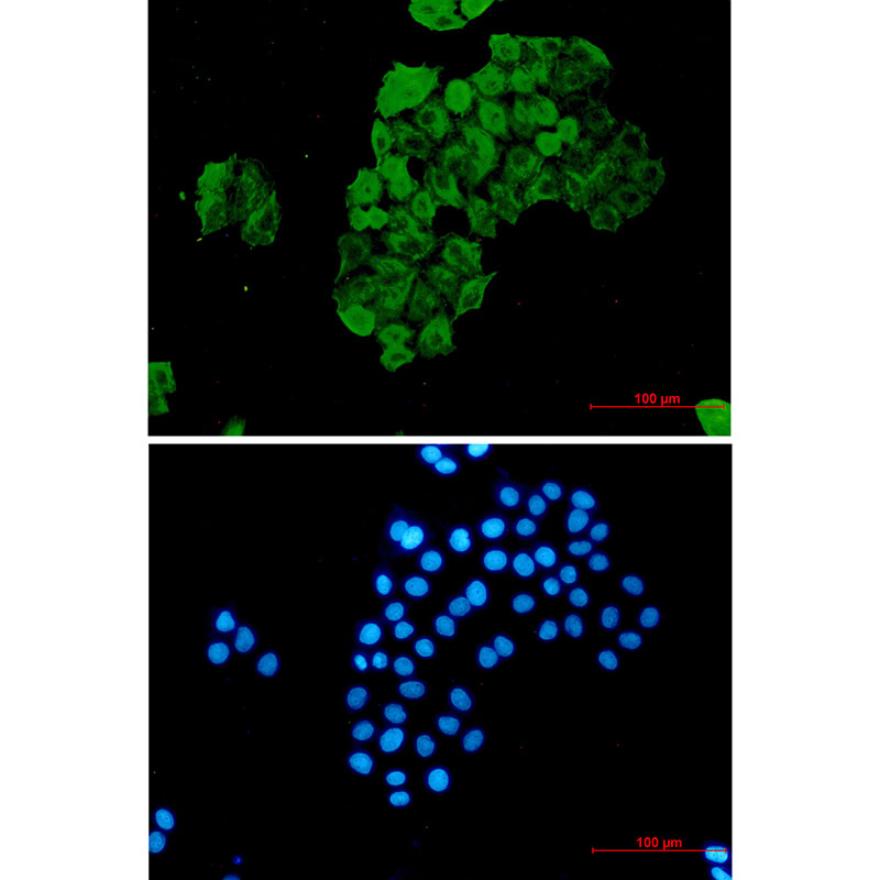 FKBP52 Rabbit mAb ABZ2255