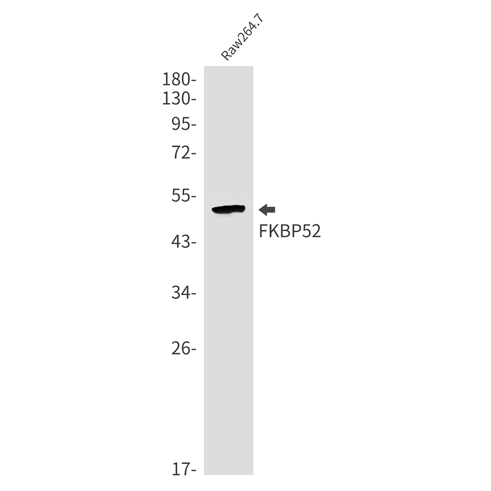 FKBP52 Rabbit mAb ABZ2255