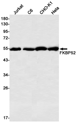 FKBP52 Rabbit mAb ABZ2255
