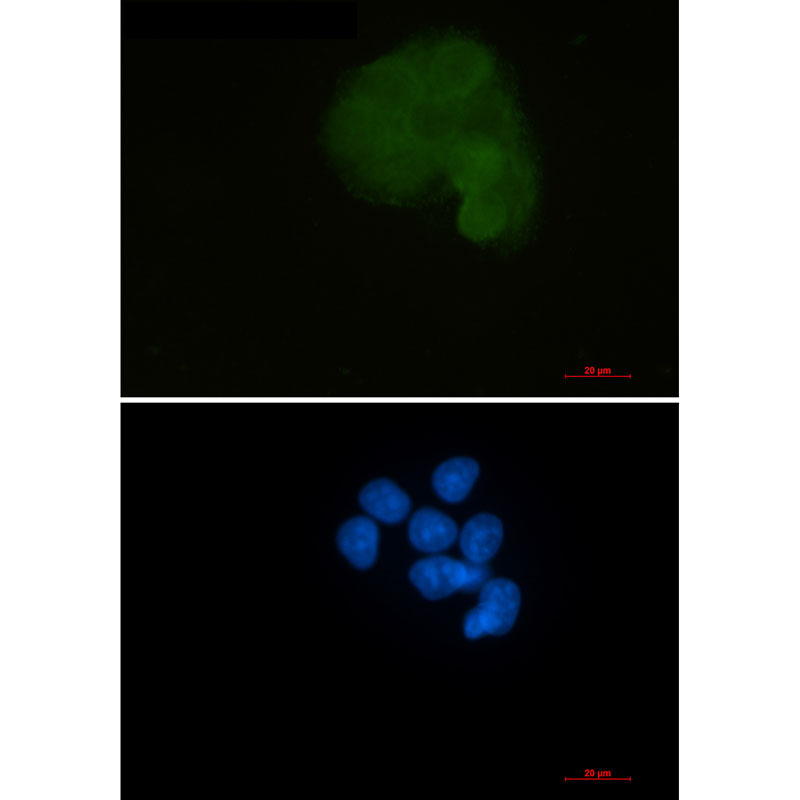 MEK1 Rabbit mAb ABZ2256