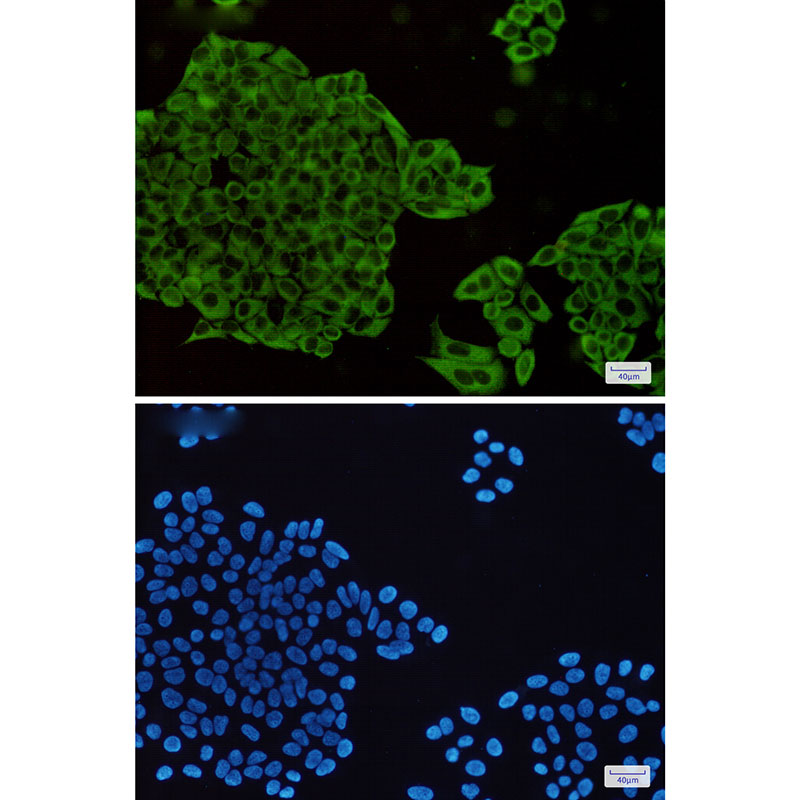 MEK1/2 Rabbit mAb ABZ2257