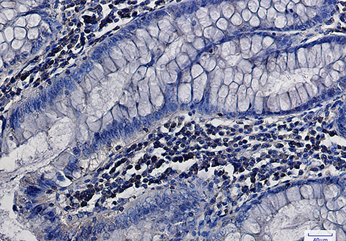 MEK1/2 Rabbit mAb ABZ2257