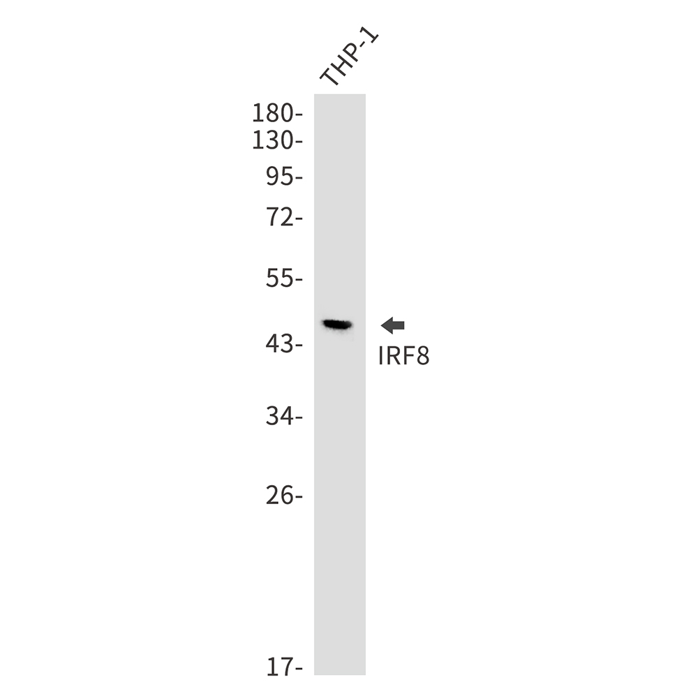 IRF8 Rabbit mAb ABZ2258
