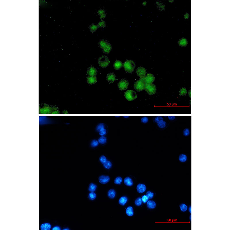 MEF2A Rabbit mAb ABZ2261
