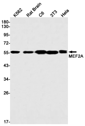 MEF2A Rabbit mAb ABZ2261