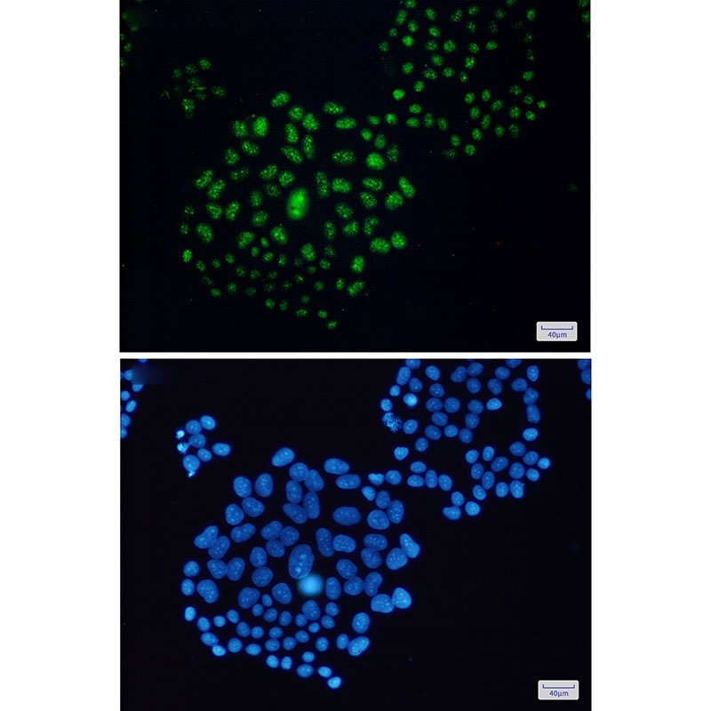 EWSR1 Rabbit mAb ABZ2263